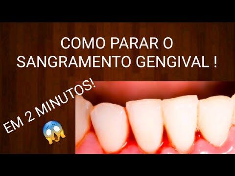 Como Estancar o Sangramento da Gengiva