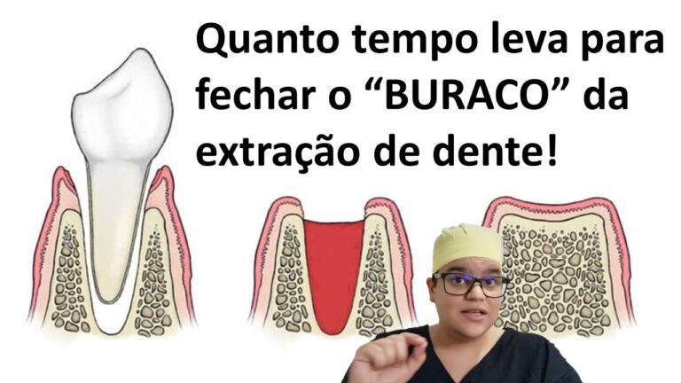 Tempo de Regeneração da Gengiva: O que Você Precisa Saber