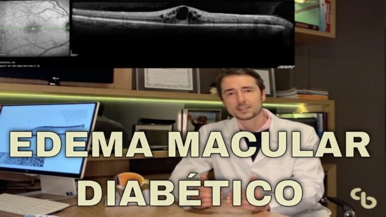 Entendendo o Edema na Retina: Causas e Tratamentos