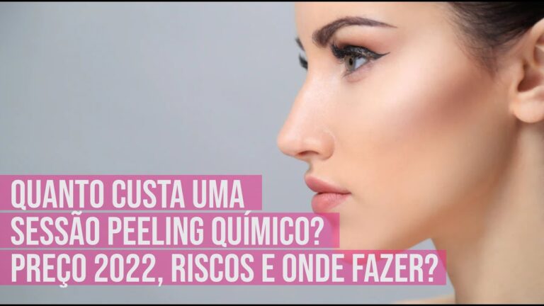 Preço do Peeling Químico: O Que Você Precisa Saber
