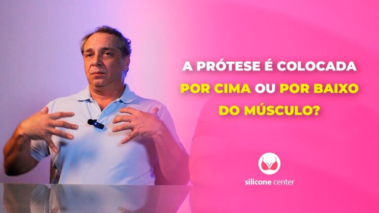 Protetores Musculares: A Descoberta da Pr&oacute;tese Submuscular