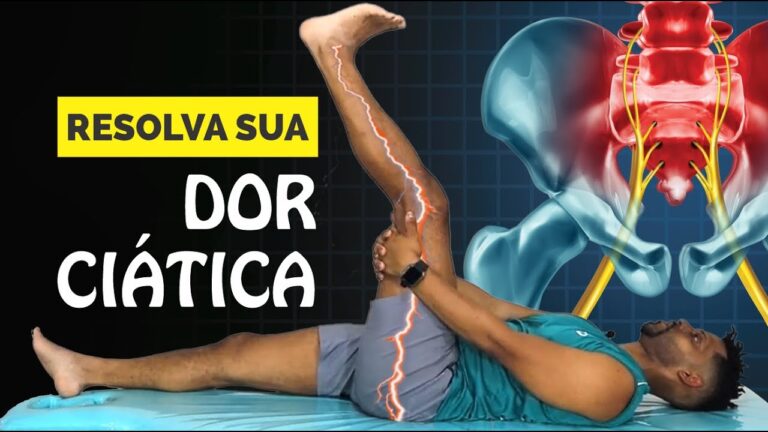 Estratégias Eficazes para Aliviar a Dor do Nervo Ciático