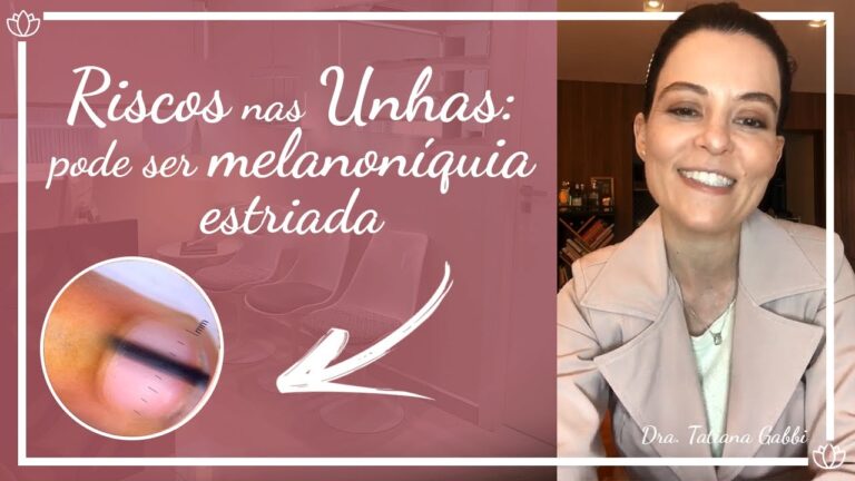 Riscos Pretos nas Unhas: Causas e Tratamentos
