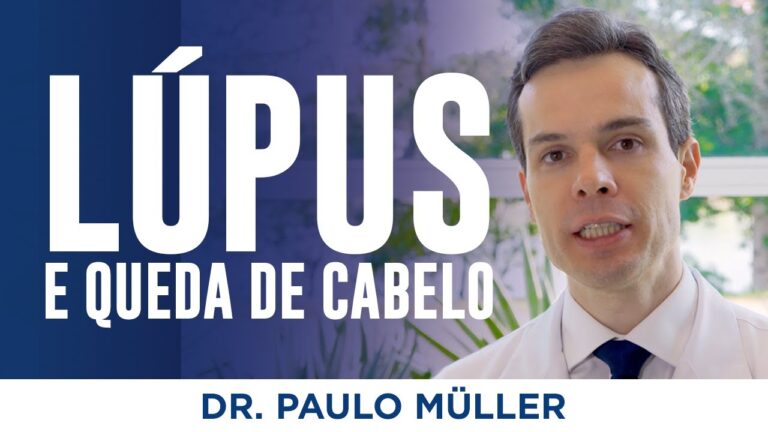 L&uacute;pus no Couro Cabeludo: Imagens e Informa&ccedil;&otilde;es Essenciais