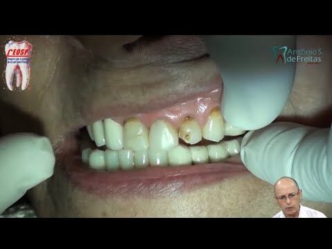Transformação Através da Restauração Estética