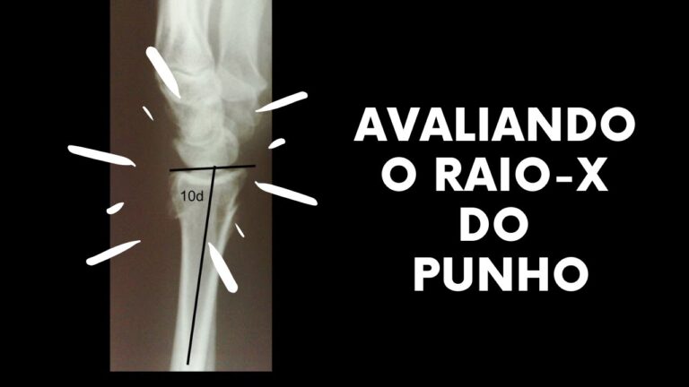 Raio-X de Pulso Aberto: Uma An&aacute;lise Abrangente