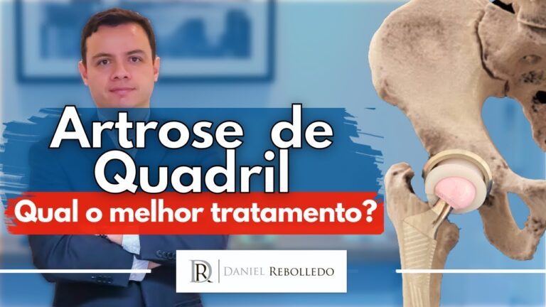 Remédios Eficazes para o Desgaste no Quadril
