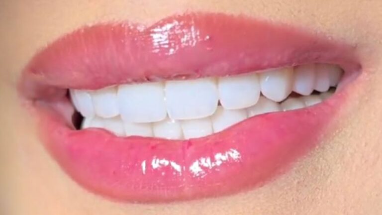 Preço da Ponte Dentária Móvel: O Que Você Precisa Saber