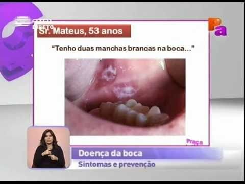 Causas e Tratamentos para Doença na Boca