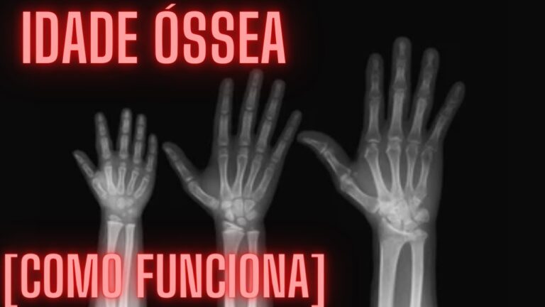 Raio X da Mão de Bebê: Importância e Cuidados