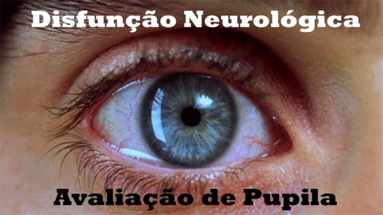 Entendendo as Pupilas Normais e Sua Importância na Saúde Ocular
