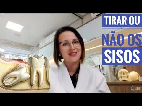 A Importância de Extrair o Siso para a Saúde Bucal