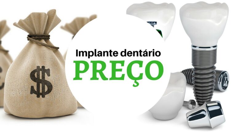 Valor do Enxerto Ósseo: Benefícios e Considerações