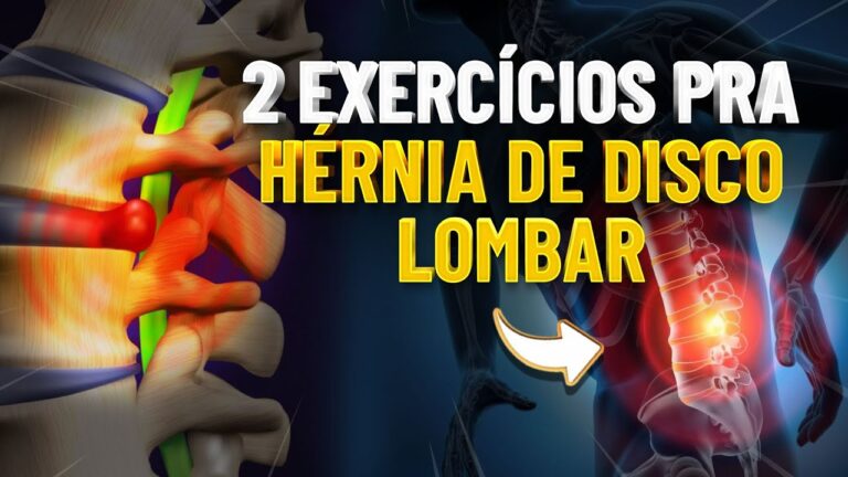 O Melhor Exercício para Quem Tem Hérnia de Disco