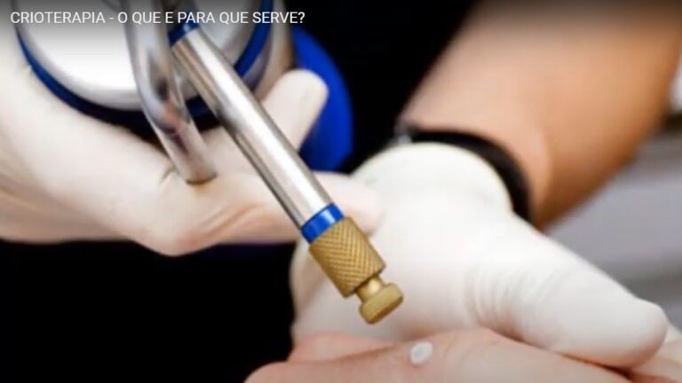 Bolha após Crioterapia: Causas e Cuidados Essenciais