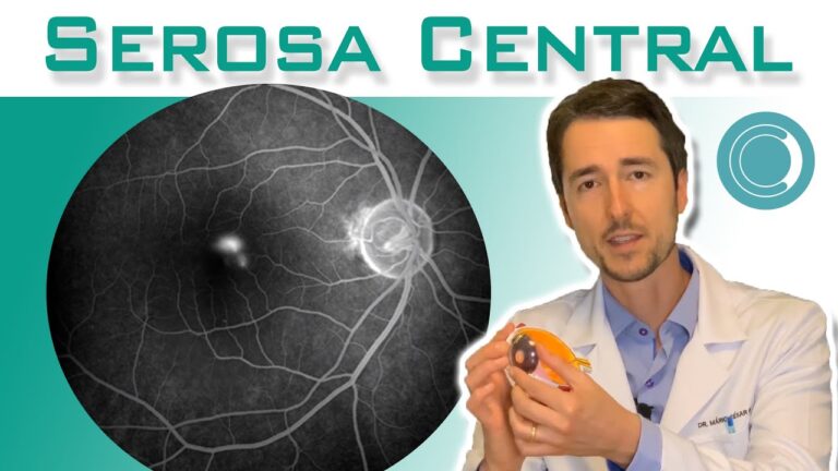 Líquido na Retina: Possibilidades de Cura