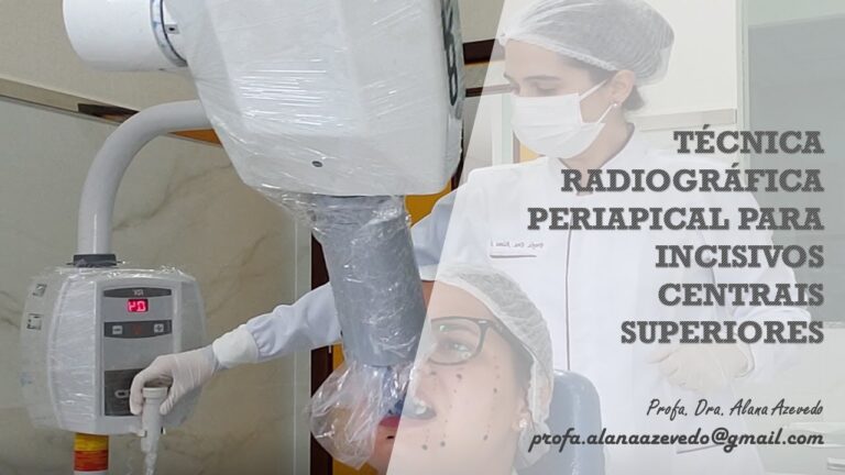 Radiografia Periapical de Incisivos Superiores: Importância e Interpretação