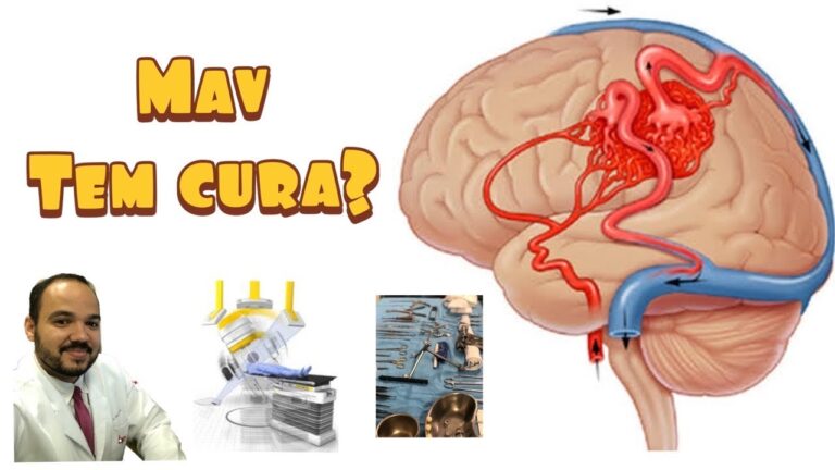 MAV no Rosto: Causas, Sintomas e Tratamentos Eficazes