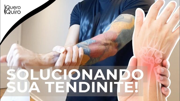 Como Tratar Tendinite no Pulso: Dicas e Cuidados Essenciais