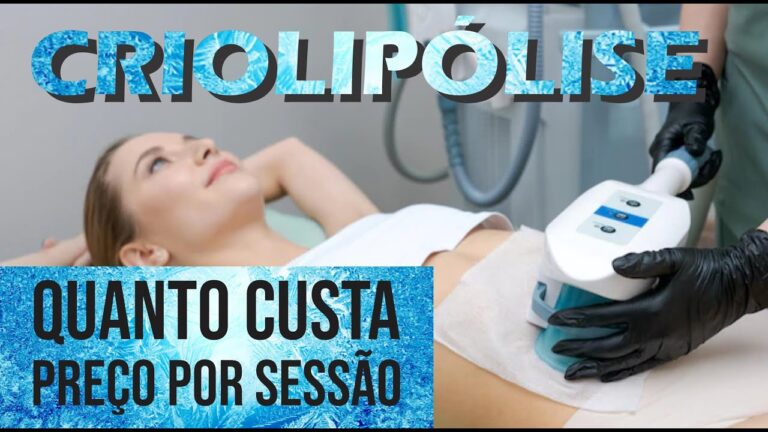 Preço da Sessão de Criolipólise: O Que Você Precisa Saber