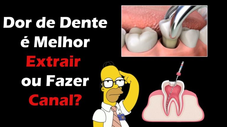 Dicas para Aliviar a Dor de Cárie Profunda