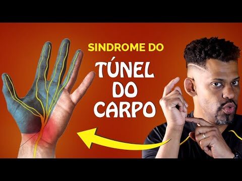 Exercícios Eficazes para Aliviar a Síndrome do Túnel do Carpo