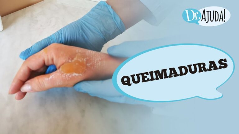 Tratamento Eficaz para Feridas Tipo Queimadura na Pele