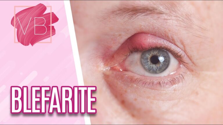 Guia Visual das Doenças das Pálpebras