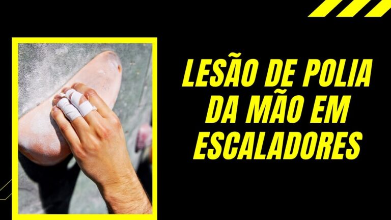 Polia Dedos: A Revolu&ccedil;&atilde;o na Reabilita&ccedil;&atilde;o Manual