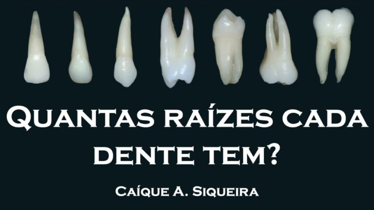 Dentes Unirradiculares: Estrutura e Importância na Odontologia