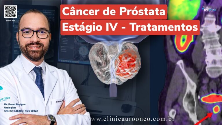 Entendendo o C&acirc;ncer de Pr&oacute;stata Est&aacute;gio 4: Sintomas e Tratamentos