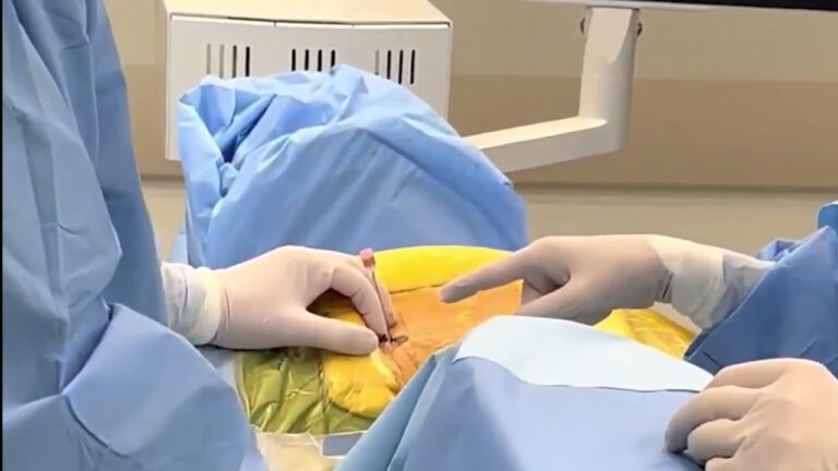 Avanços na Cirurgia de Coluna por Via Endoscópica