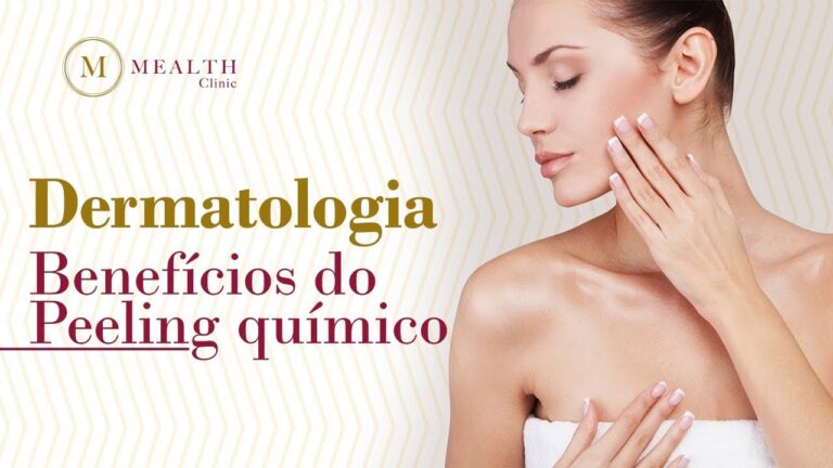 Benef&iacute;cios do Peeling Qu&iacute;mico para a Pele