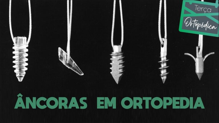 Cirurgia do Manguito Rotador com Âncora: Avanços e Benefícios
