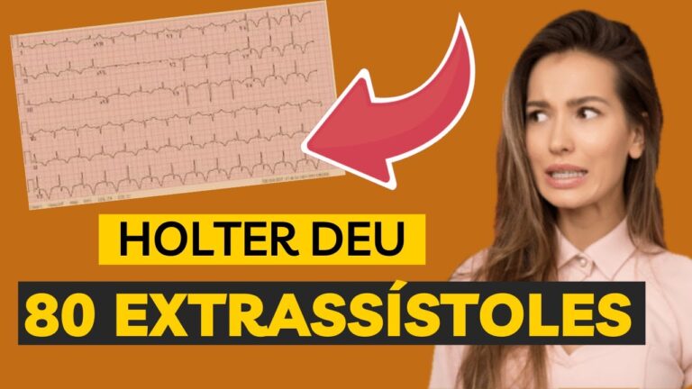 Interpretação dos Resultados do Holter 24 Horas