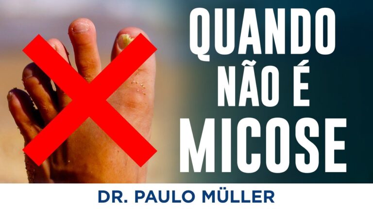 Conheça as Principais Doenças das Unhas dos Pés
