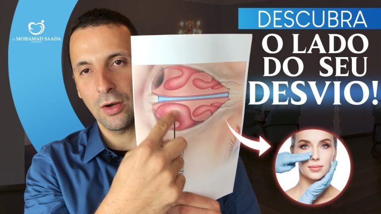 Como Identificar o Desvio de Septo Nasal | Actualizado junio 2026