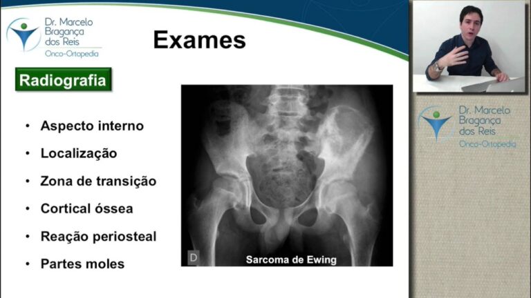 Raio-X: Detecção Precoce de Câncer na Coluna