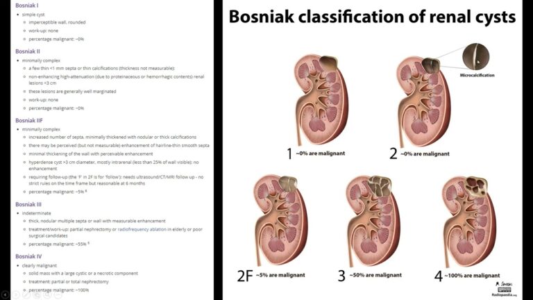 Classificação Bosniak: Entendendo os Tipos e Implicações Clínicas