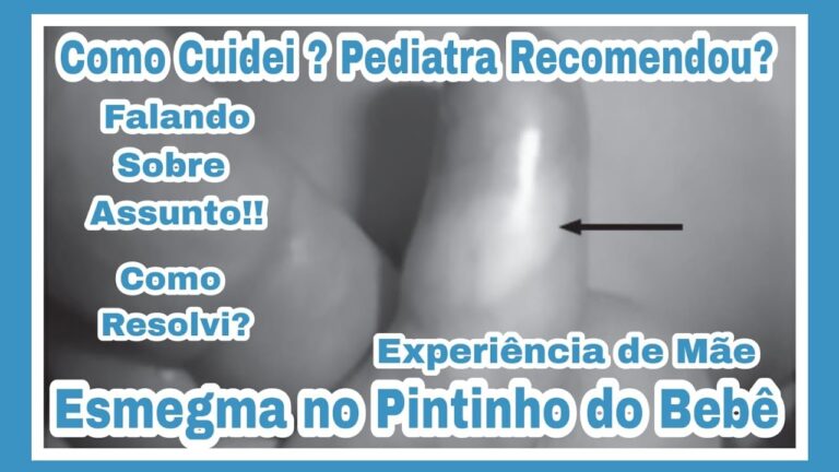 Como Tratar Esmegma Infantil Eficazmente