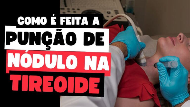 Entendendo a Pulsão da Tireoide: Causas e Consequências