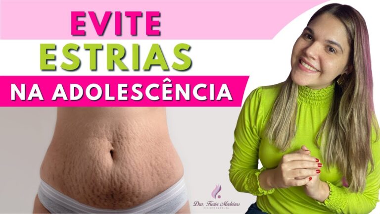Estrias na Adolescência: Compreensão e Normalidade