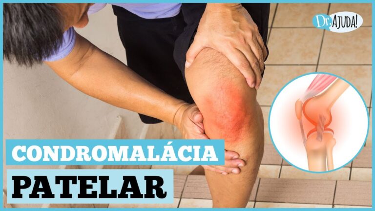 Entendendo a Condropatia Patelar: Uma Doença Degenerativa em Foco