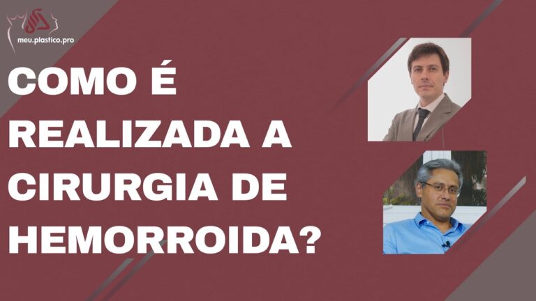 Entenda como é a cirurgia de hemorróida
