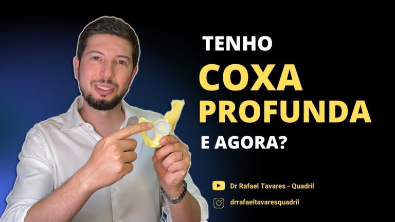 Coxa Profunda Bilateral: Causas e Tratamentos Eficazes