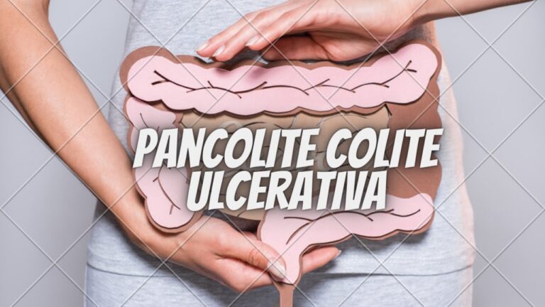 Entendendo a Pancolite: Causas, Sintomas e Tratamentos