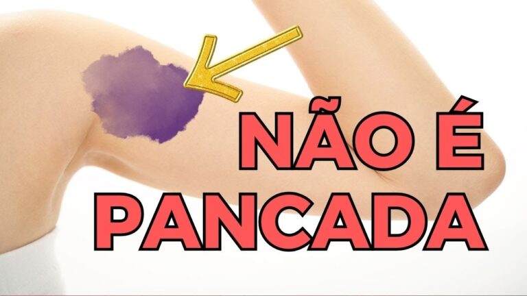 Manchas Roxas na Gengiva: Causas e Tratamentos