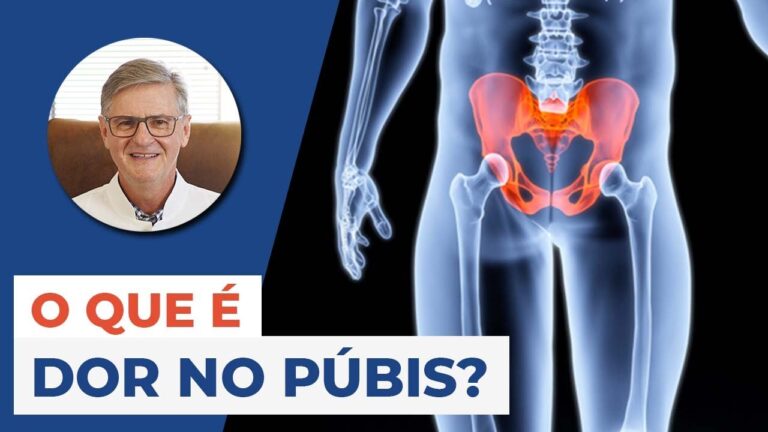 Entendendo a Sinfisite Púbica: Causas e Tratamentos