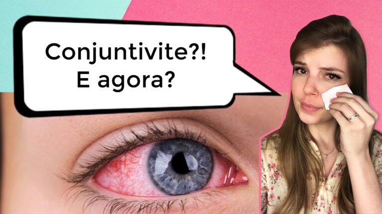 Sinais de Melhora na Conjuntivite: Como Identificar