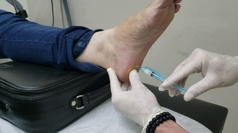 Infiltração no Calcanhar: Causas e Tratamentos Eficazes